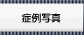 症例紹介